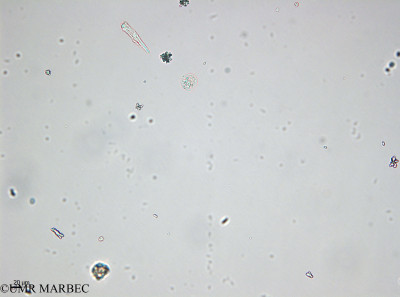 phyto/Bizerte/bizerte_bay/RISCO April 2014/Prorocentrum cordatum (- 140729_001_ovl-3)(copy)_thumb.jpg